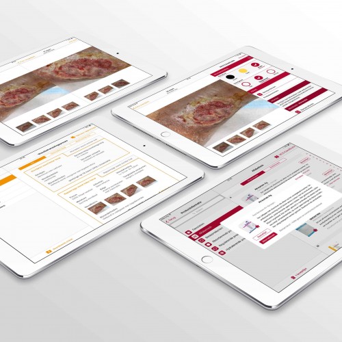 Eerste Hulp bij Wondapplicaties